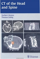 N. Hosten, T. Liebig CT of the Head and Spine. 2002 год