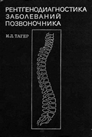 Тагер И.Л. Рентгенодиагностика заболеваний позвоночника. 1983 год