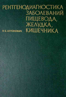 Антонович В. Б. Рентгенодиагностика заболеваний пищевода, желудка, кишечника. 1978 год